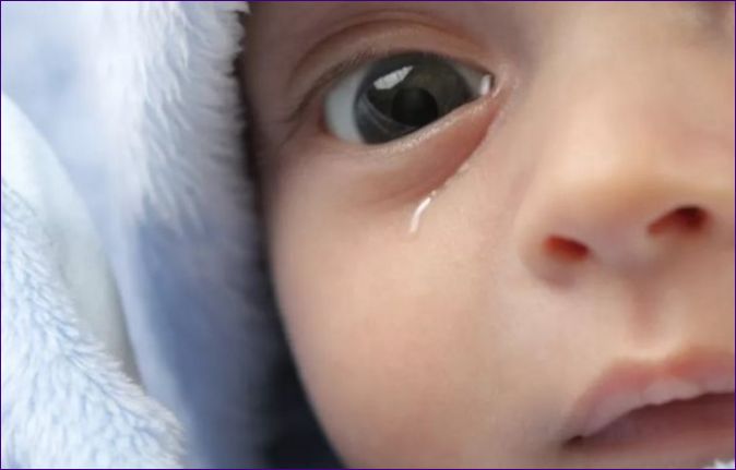Łzawiące oko niemowlęcia